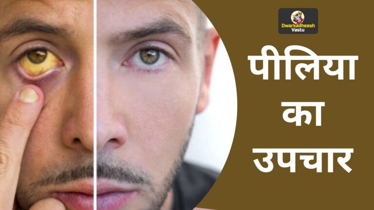 पीलिया का उपचार